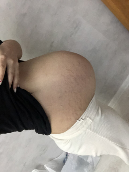 Опустился живот ?