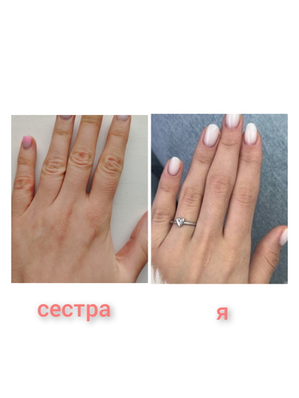 Помогите! Что с руками не так?