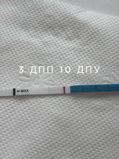 5 дпп хвост укола или же мои //👀🫃