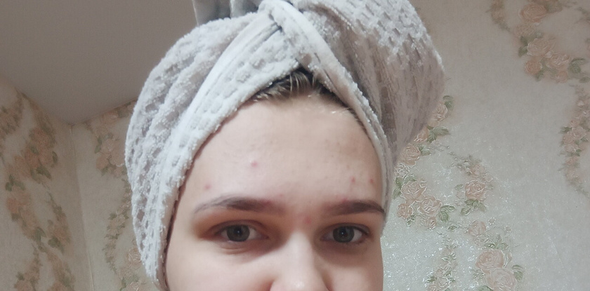 Прыщи