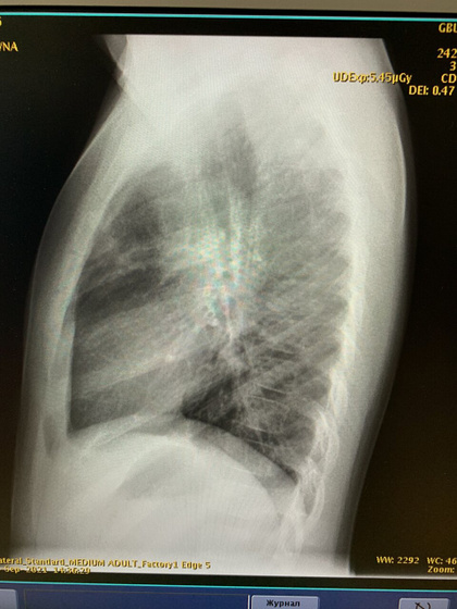 Кто-то может определить по фото чего завтра ожидать в описани