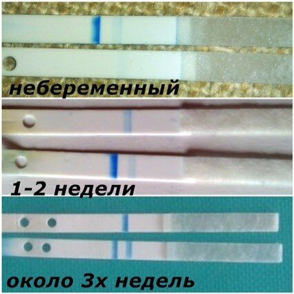 Кто разбирал Электронный клиа?