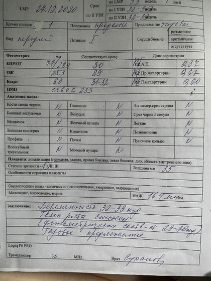 СЗРП