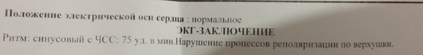 Результат ЭКГ