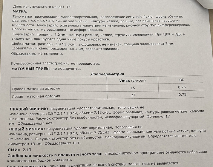 Нужно ваше мнение