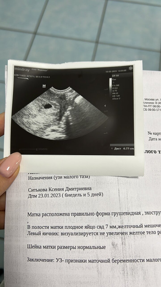 Мазня 2. Нет сердцебиения