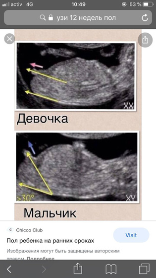 Мальчик или девочка ????
