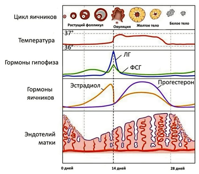 Мигрень