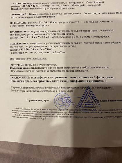 Узи