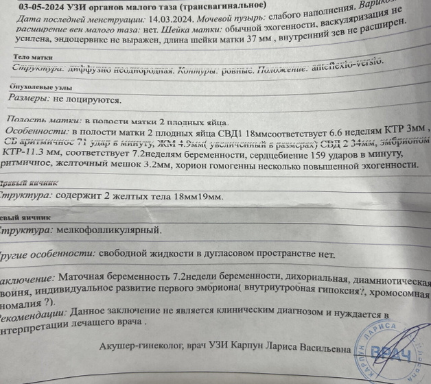 Сегодня была на узи,