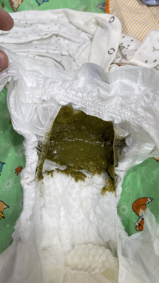 Могут быть зелёные какашки