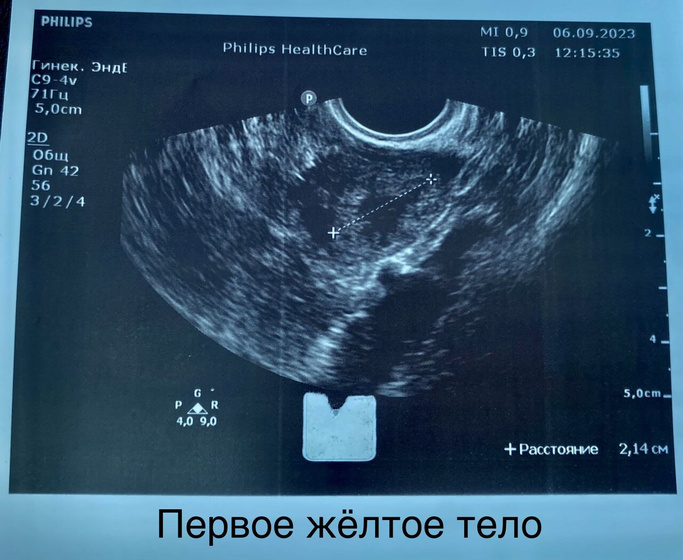 22 день цикла ( поход на узи и сон 😱) ✨