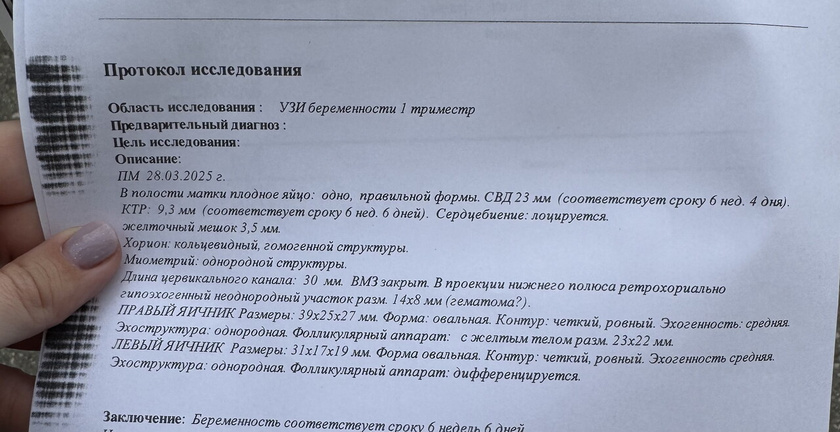 Была на узи недавно,