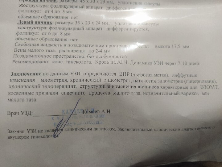 Сходила сегодня на УЗИ