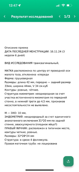 Не выдержала) сходила на узи)