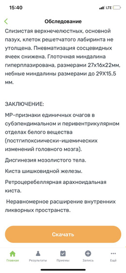 Мрт