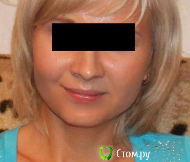 Хочу брекеты очень ,