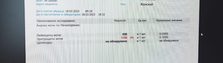 Кто разбирается, сильно завышены