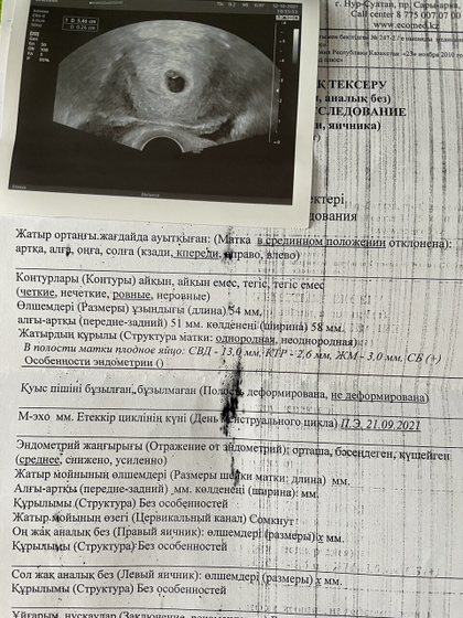 21 дпп