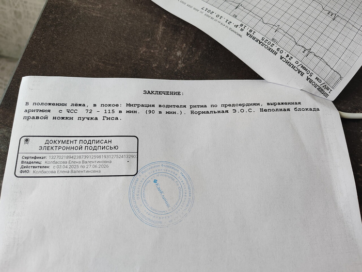 Экг результат