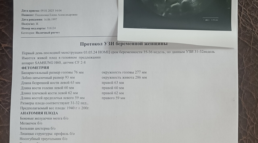 Узи
