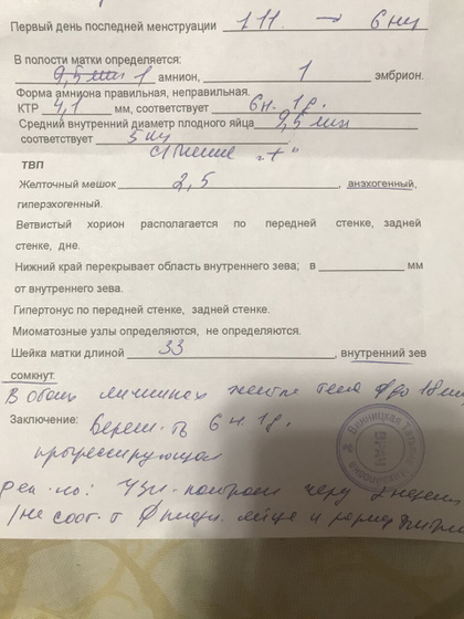 Девочки,Была на узи на