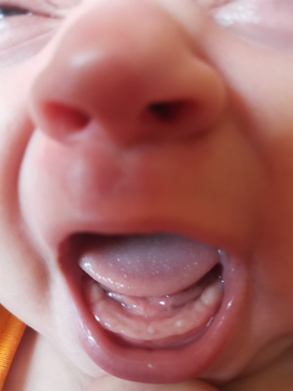 Зубы