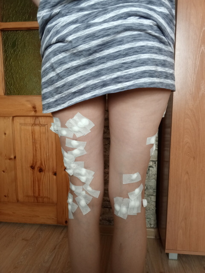 КЛАКС операция