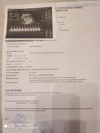 10 недель и долгожданное