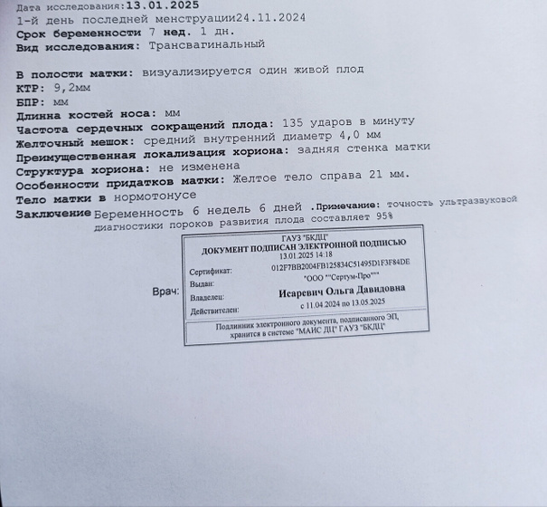 Узи