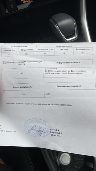 Анализ фрагментации ДНК сперматозоидов