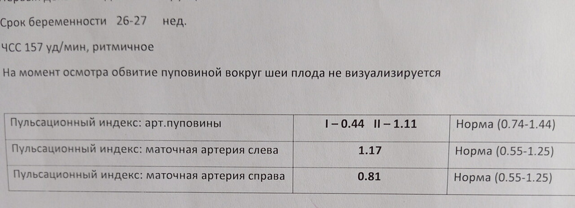 Доплер