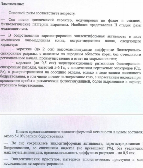 Эпилепсия. Результат ночного ээг (мой)