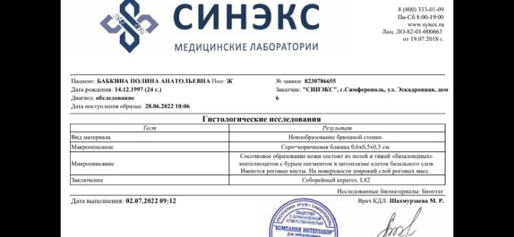 Удаляю уже 4 родинку