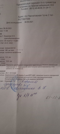 Вентрикуломегалия,дизгенезия мозолистого тела, агенезия прозрачной перегородки