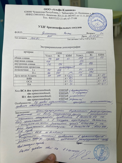 УЗИ сосудов