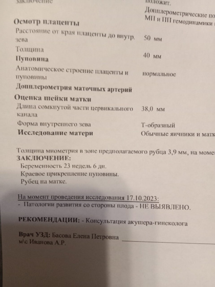 Я что то путаю?