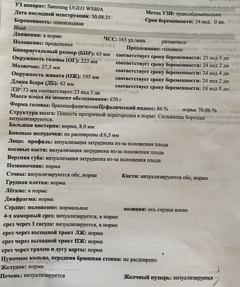 Брахицефалическая окружность головы