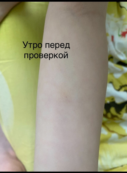 Итоги по диаскину .