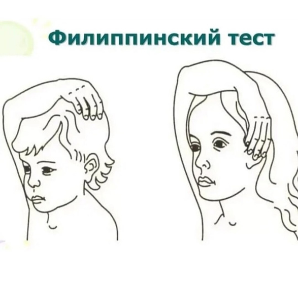 Филиппинский тест