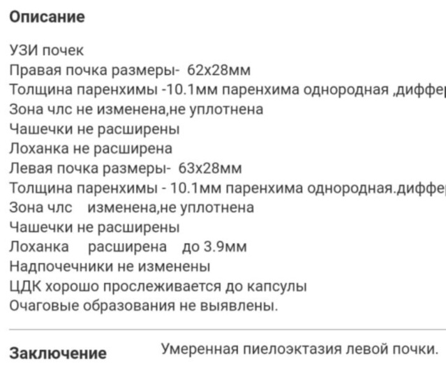 У ребенка на узи