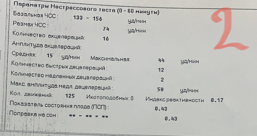 34 недели 2 дня. КТГ, допплер