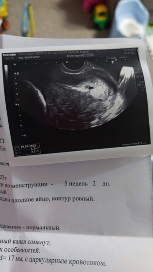 Дождалась первого узи, все