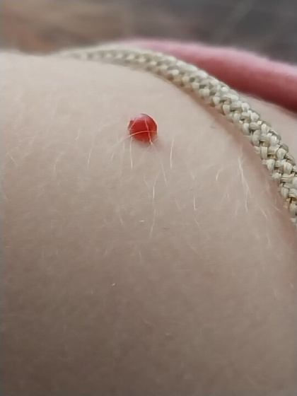 Девочки что это может