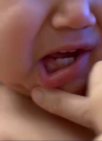 Сколько дней при клыках