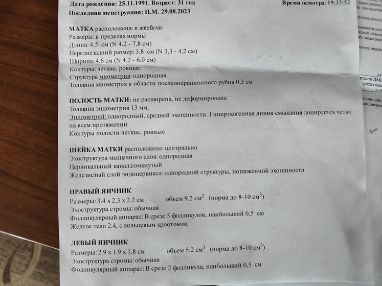 Записали меня на УЗИ