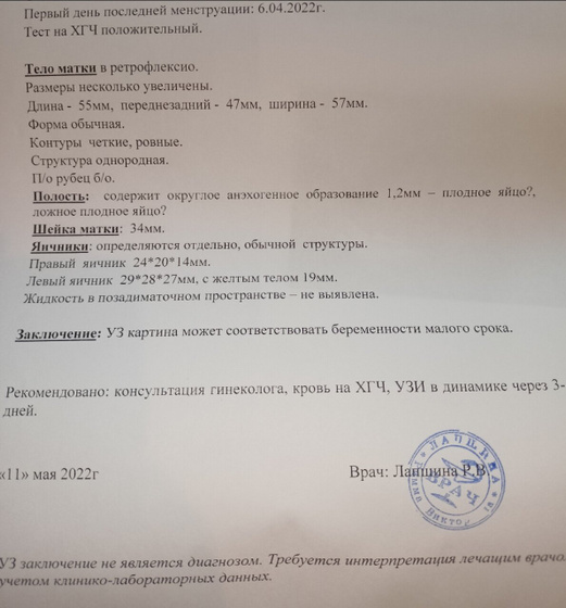 Сходила, я на УЗИ,