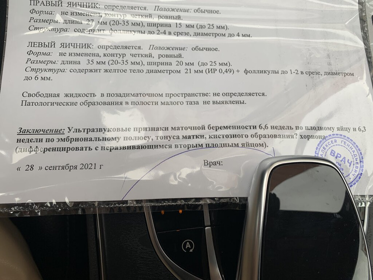 Сделала узи