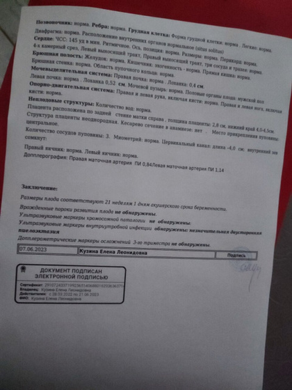 Второй скрининг