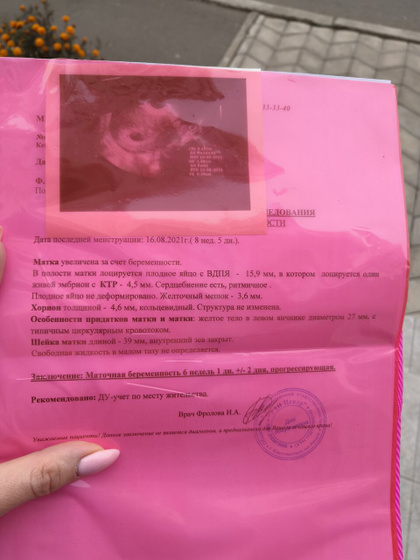 Сегодня увидели эмбрион, сердечко.